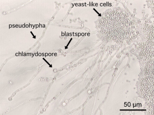 Hefepilz Candida Albican